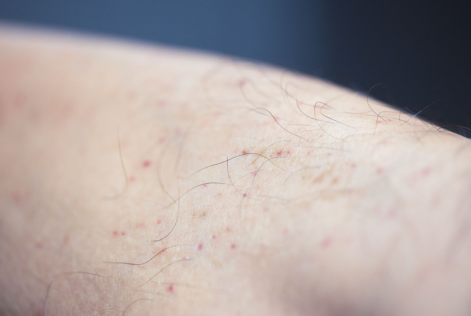 いつ医師や他の医療専門家に相談すべきですか?