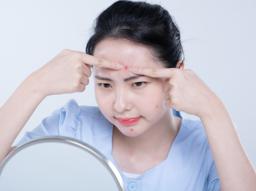 여드름 약 증상별 추천, 내 여드름엔 어떤 약이 좋을까? 바르는 약 vs 먹는 약 썸네일