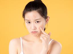 레티노이드 처음이라면? 여드름 연고 입문템 '디페린' 사용법·효과·주의사항 총정리 썸네일