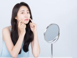 여드름 연고 아크리프, 여드름 약 이소티논 비대면 진료 가능할까? 여드름약 처방받는 법 썸네일
