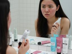 여드름 치료해도 안 낫는 얼굴 트러블? ‘주사 피부염’일 수 있어요  썸네일