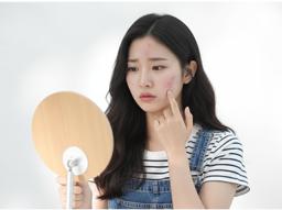 여드름 치료 시작템 디페린(성분명:아다팔렌) 제대로 쓰는 법｜효과·사용법·가격·처방 안내 썸네일