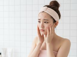 봄철여드름 심해졌나요? 마스크여드름과 환절기 피부관리 방법 총정리 썸네일
