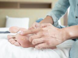 무좀치료 시작 전 꼭 확인! 무좀연고 성분 비교와 무좀관리방법 썸네일