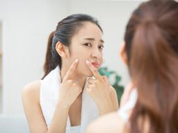 나딕사 크림은 어떤 약인가요? 여드름 연고 제대로 알고 사용하기 썸네일