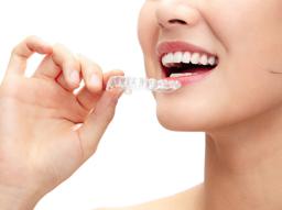 치아교정기로 개방교합 치료 가능할까? 인비절라인 비용과 실제 사례 썸네일