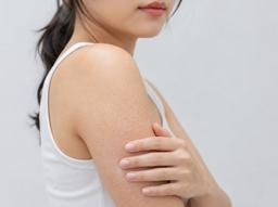팔·다리 모공각화증, 여름철 더 신경 쓰인다면? 치료 방법 확인하기 썸네일