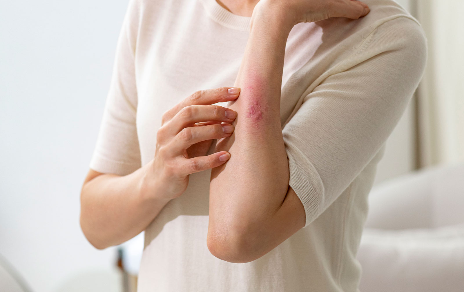 帯状疱疹ワクチン