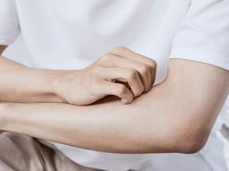 "장미색 비강진이 뭐예요?" 피부 감기로 불리는 장미색 비강진의 모든 것 썸네일