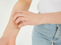 추워질수록 심해지는 "피부 건조증" 치료, 보습제, 원인, 증상  썸네일