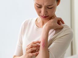 [1분 FAQ] 대상포진 전염성은 얼마나 강한가요? 썸네일