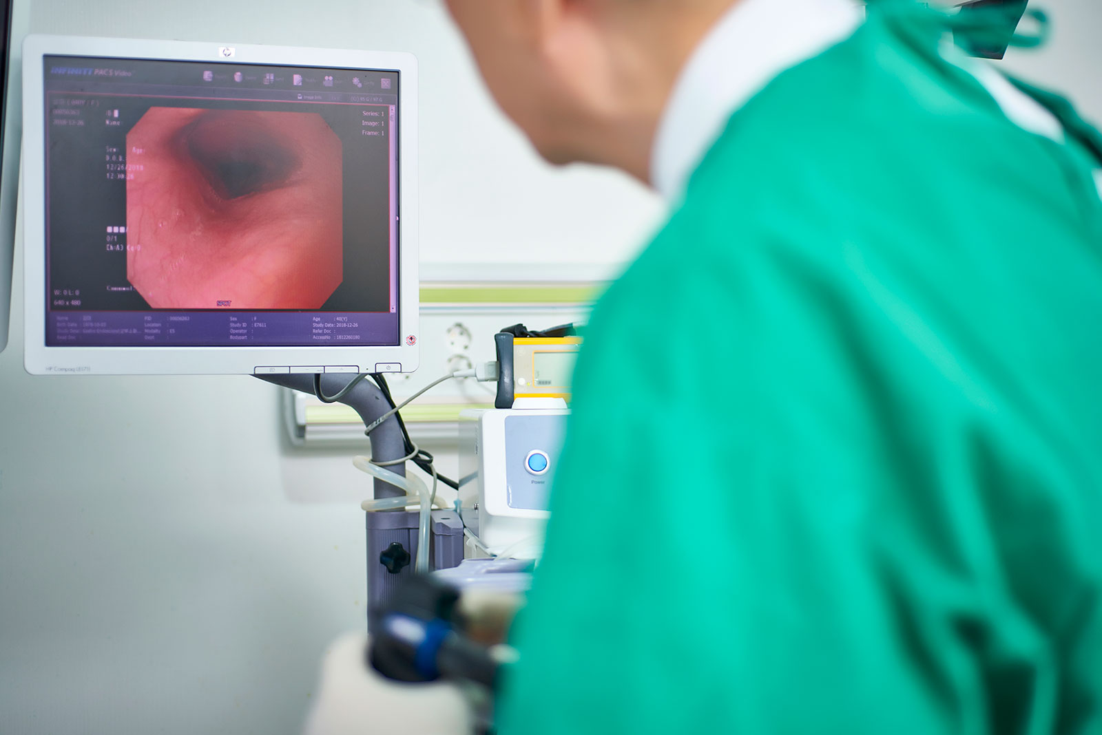 空腹時血液検査の前に避けるべきことは何ですか?