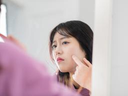 이소티논 효과 언제부터 나타날까? 이소티논 효과, 부작용, 처방법 썸네일